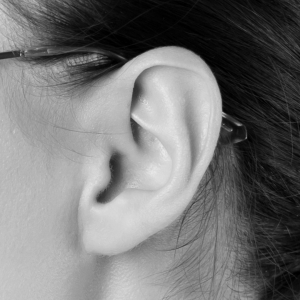 Earlobe Reduction