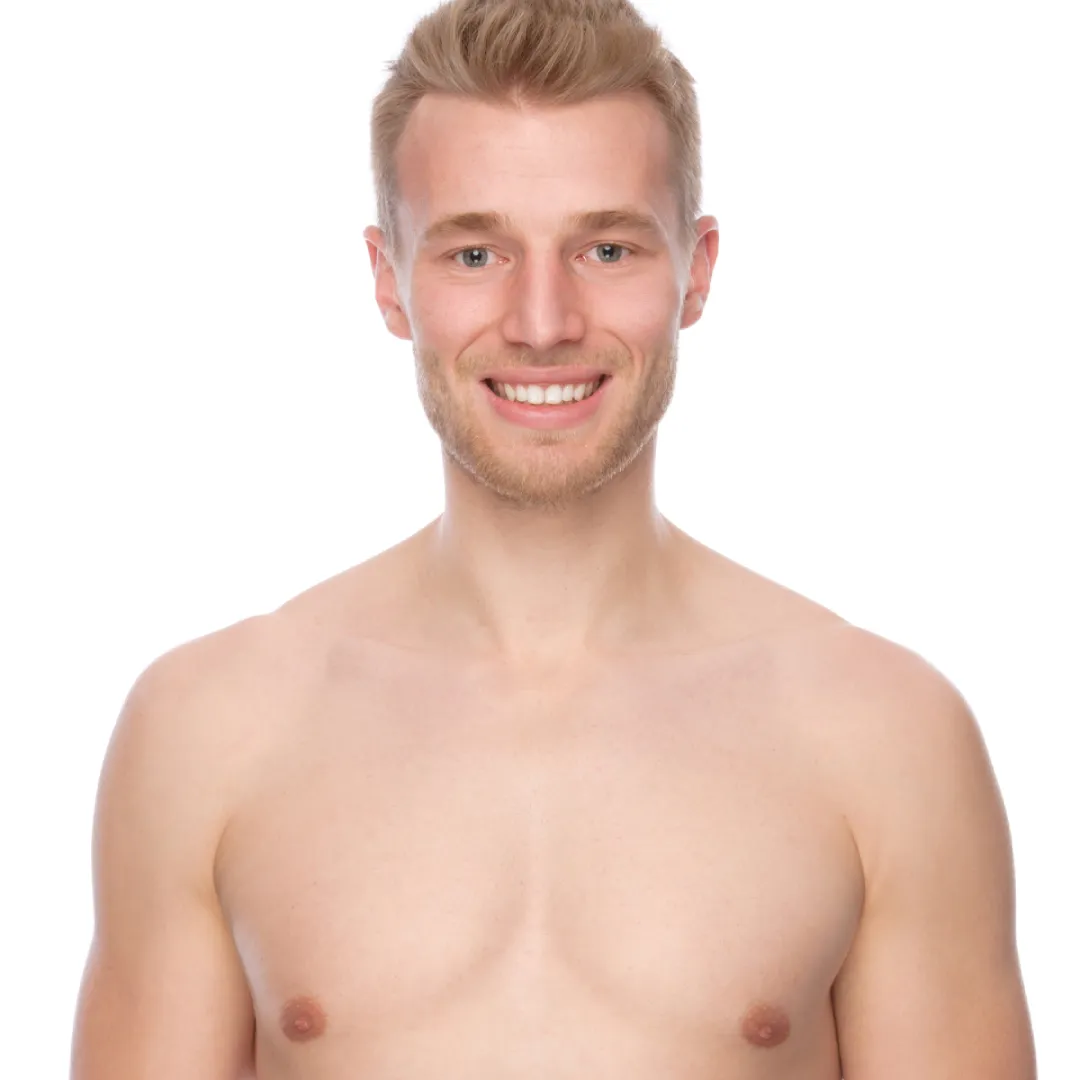 A man having his chest drawn on and prepped for surgery with a marker pen